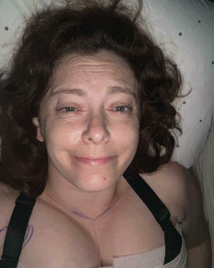 When Rachel Bloom Shared This Candid Selfie Immediately After Her Breast Reduction Surgery