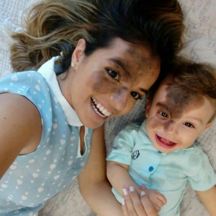 After realizing societal judgment about her son's distinctive appearance, this mother hired a makeup professional to replicate his birthmark on his face.