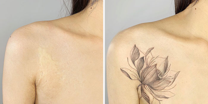 50 Times People Asked To Cover Up Their Scars, And This Tattoo Artist Nailed It (New Pics)