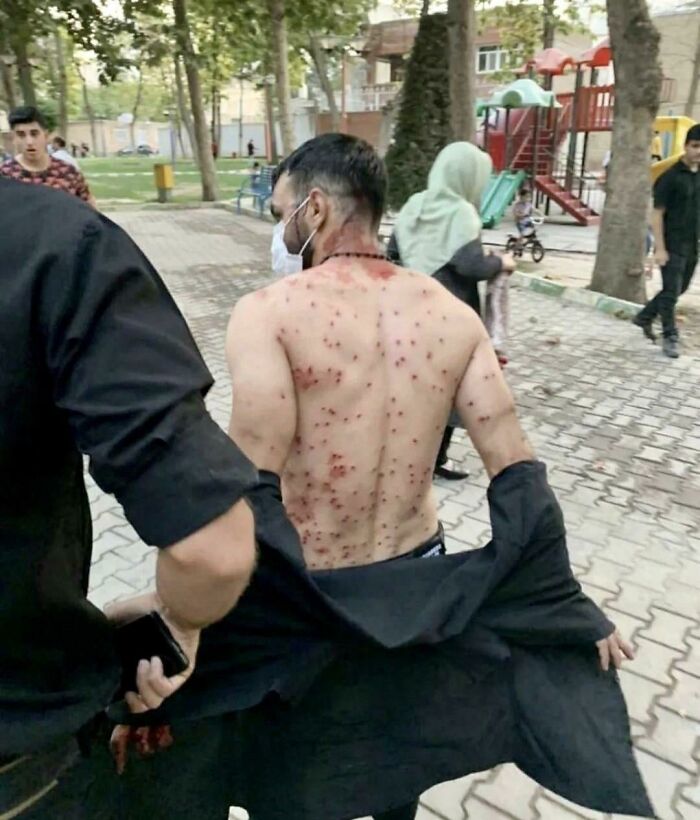 Un hombre protegió a muchas mujeres haciendo de escudo y se llevó todos los disparos de una escopeta de balines durante una protesta contra el Hijab en Teherán