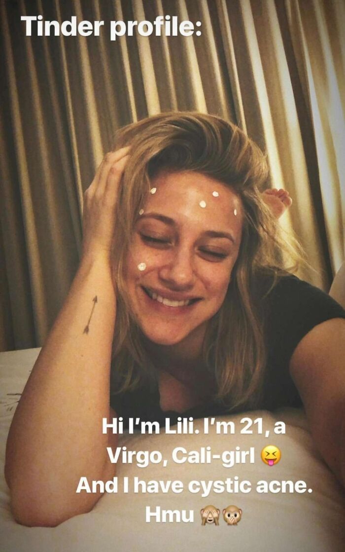 When Lili Reinhart Joked About Her Very Real Struggle With Cystic Acne