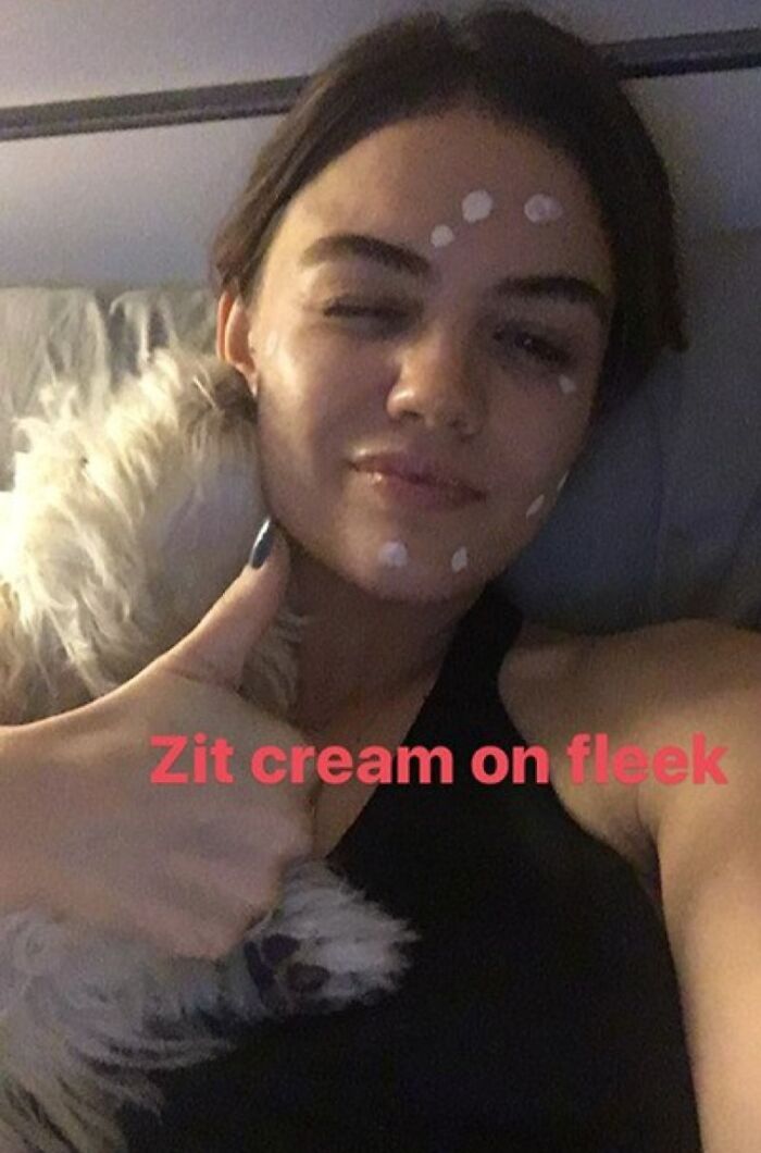 When Lucy Hale Smiled For The Camera With Her "Zit Cream On Fleek"