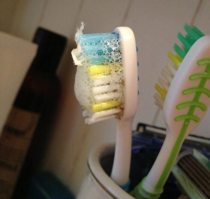 My Father-In-Law's Toothbrush. Those Brown Bits Are Some Kind Of Mouldy Cereal