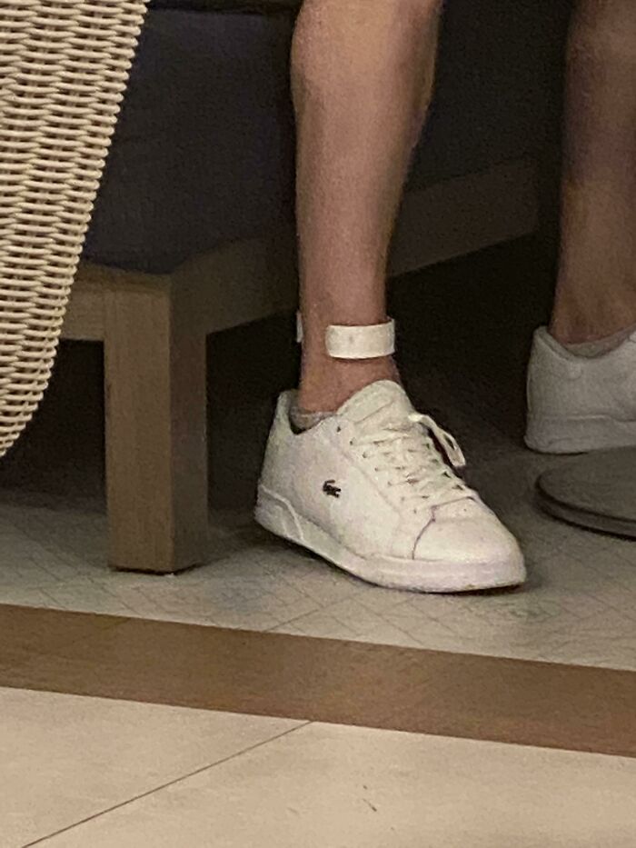 Guy Wearing This Ankle Thing At A Vacation Resort In The Caribbean… What Is This Thing?