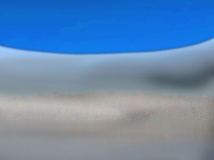 My Retina Detached And This Is What It Looked Like "Through My Eyes" My Retina Detached And This Is What It Looked Like "Through My Eyes"