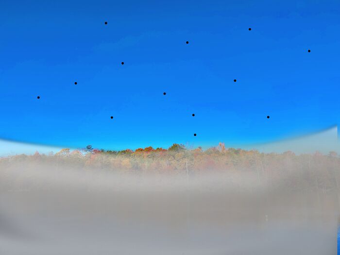 My Retina Detached And This Is What It Looked Like "Through My Eyes" My Retina Detached And This Is What It Looked Like "Through My Eyes"