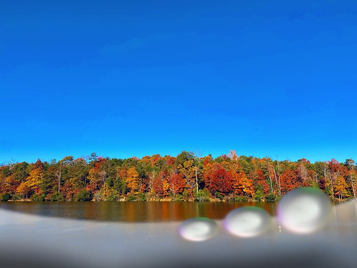 My Retina Detached And This Is What It Looked Like "Through My Eyes" My Retina Detached And This Is What It Looked Like "Through My Eyes"