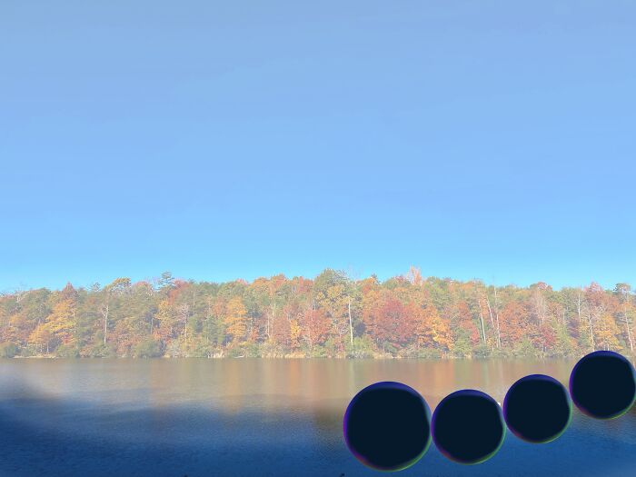 My Retina Detached And This Is What It Looked Like "Through My Eyes" My Retina Detached And This Is What It Looked Like "Through My Eyes"