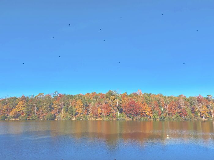 My Retina Detached And This Is What It Looked Like "Through My Eyes" My Retina Detached And This Is What It Looked Like "Through My Eyes"