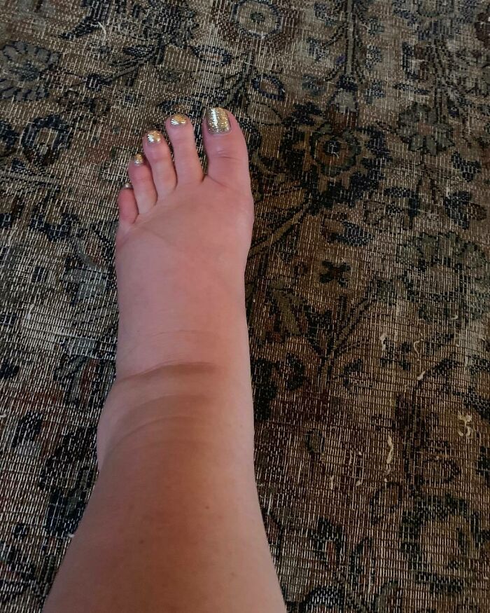 When Jessica Simpson Posted This Photo Of Her Ankles, Which Became Swollen During Pregnancy