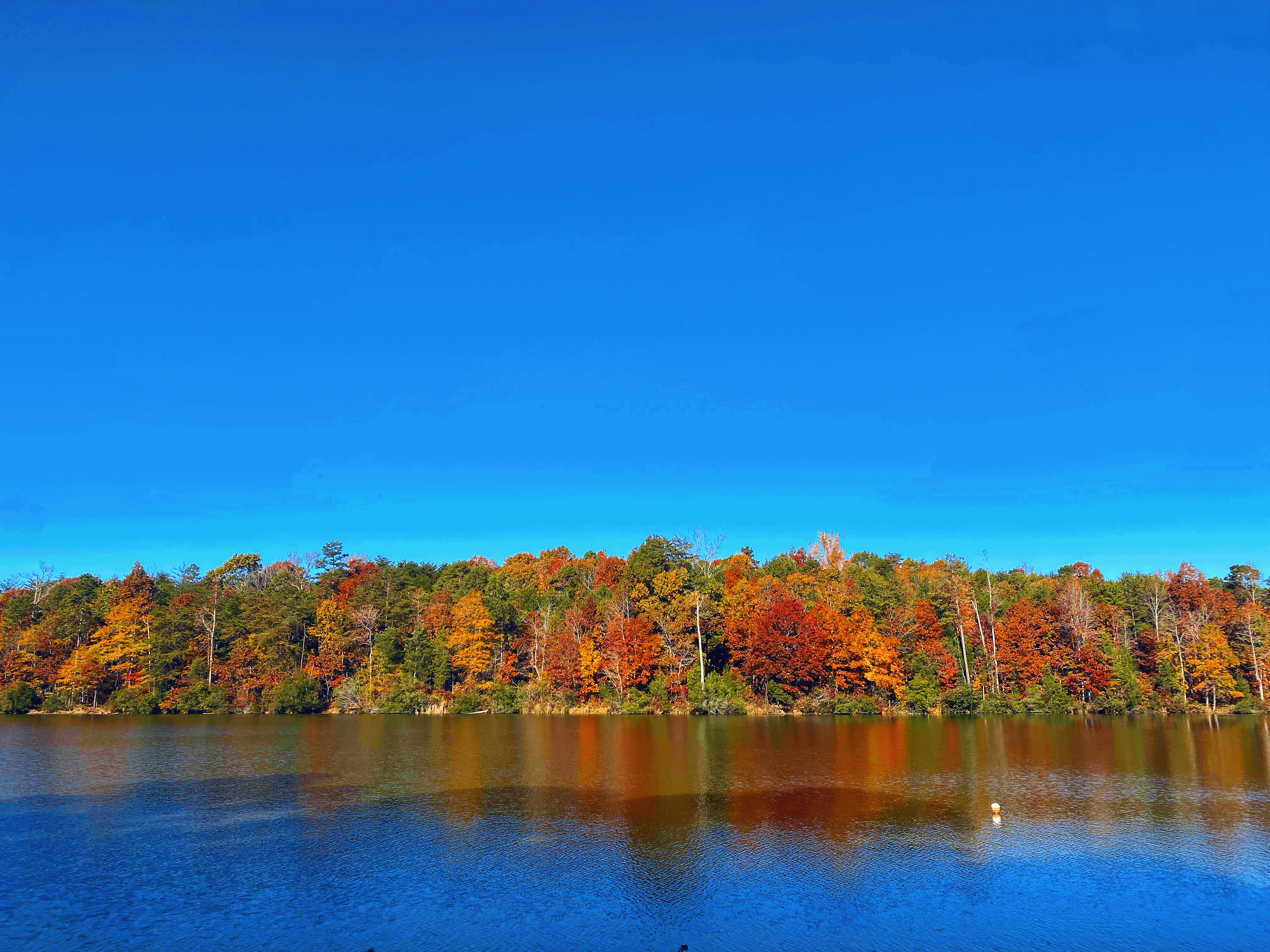 My Retina Detached And This Is What It Looked Like "Through My Eyes" My Retina Detached And This Is What It Looked Like "Through My Eyes"