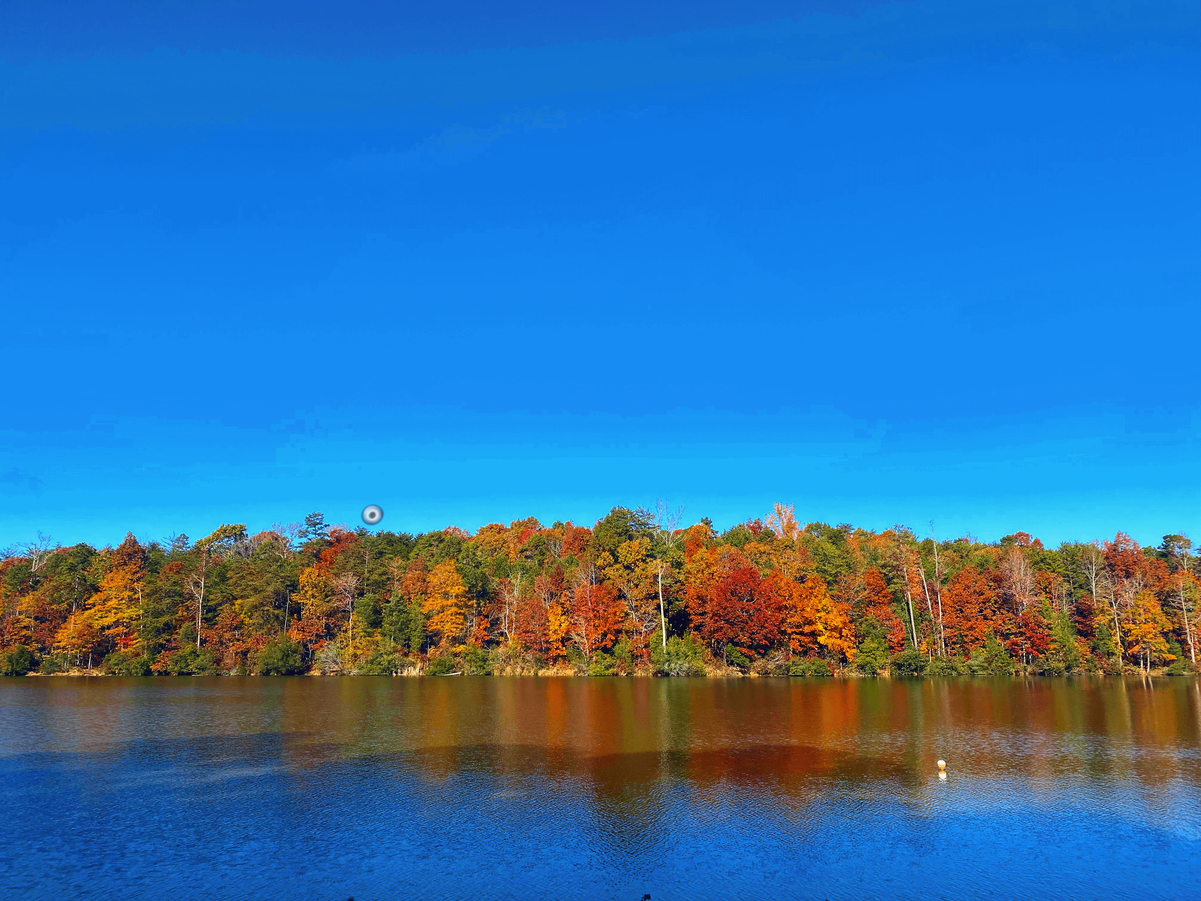 My Retina Detached And This Is What It Looked Like "Through My Eyes" My Retina Detached And This Is What It Looked Like "Through My Eyes"