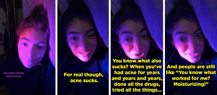 When Lorde Talked About Her Struggles With Acne And People's Unsolicited Advice About It