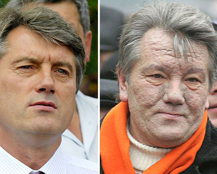 Viktor Yushchenko antes y después de ser envenenado por Vladimir Putin en 2004. Él y su familia creen que el atentado fue ordenado por Moscú cuando intentaba acercar Ucrania a Europa