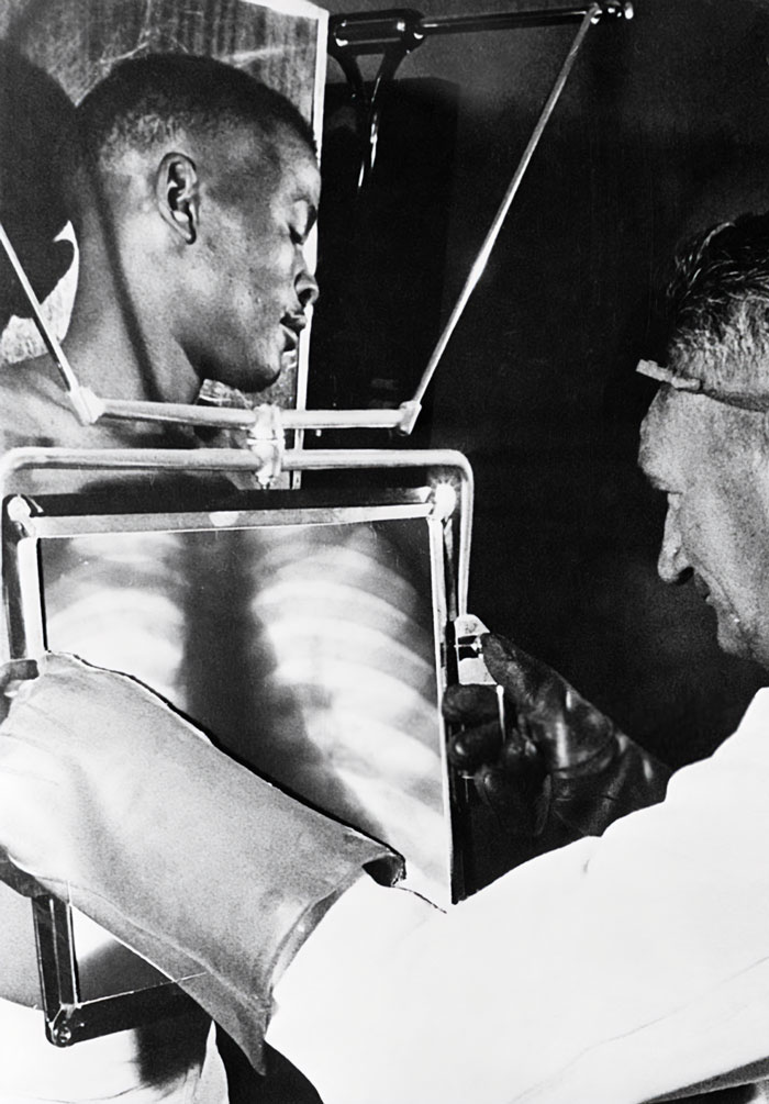 Cada día, al final del turno, los mineros tenían que pasar por la máquina de rayos X para ser inspeccionados. Algunos mineros se tragaban los diamantes, incluso los escondían en incisiones autoinfligidas en las piernas, Sudáfrica, 1954