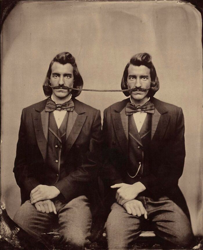 Conjoined Twins Of Mustaches, 1890