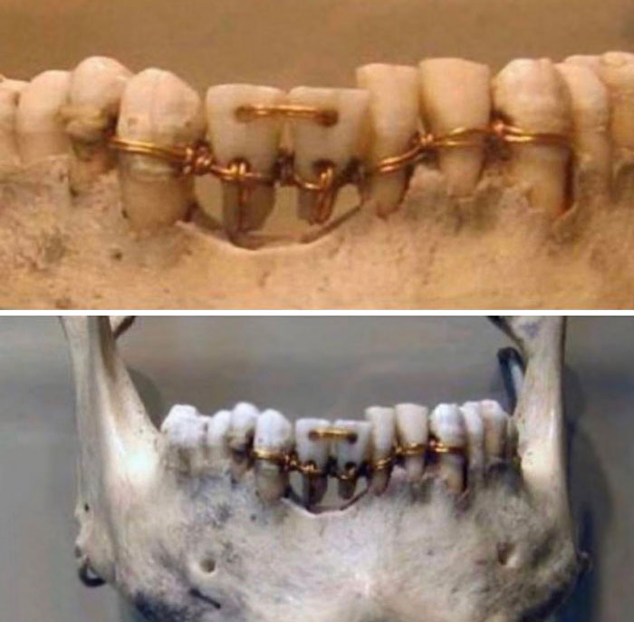 Trabajo dental del antiguo Egipto