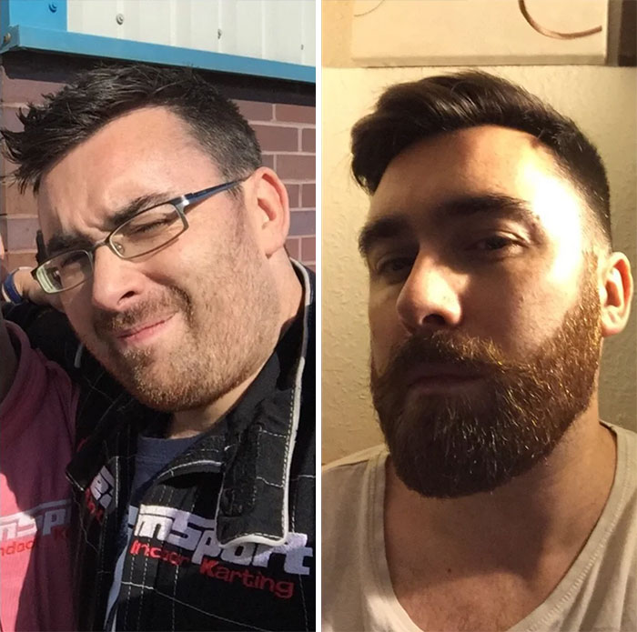 3 Months Before/After