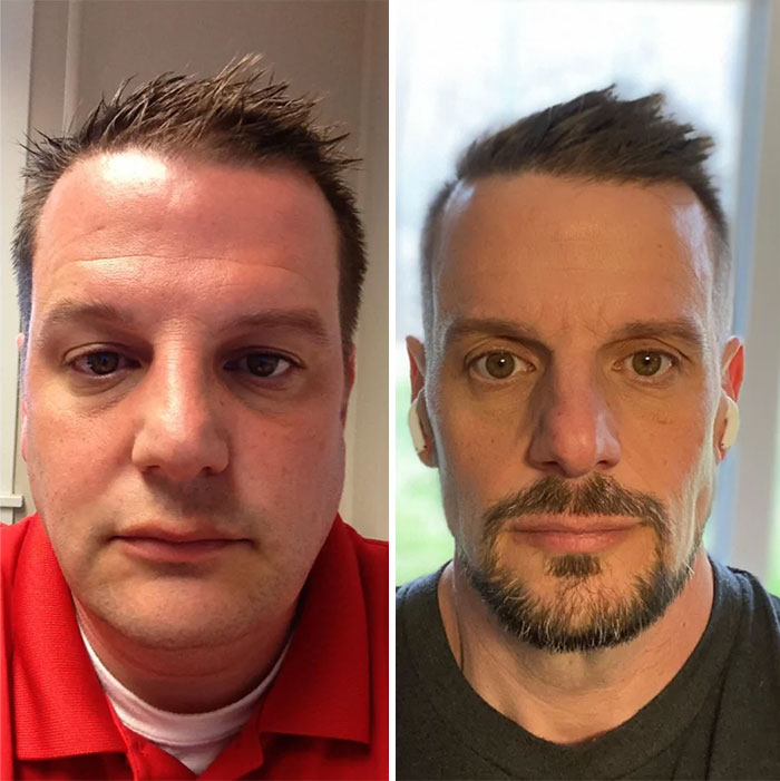 Here’s Some Wholesome Face Changes. Reminder: Take All The Before Pictures