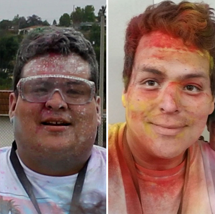 VSG Surgery Changed My Life