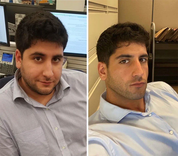 Similar Shirt, Completely Different Face. Really Amazing What The Human Body Is Capable Of!