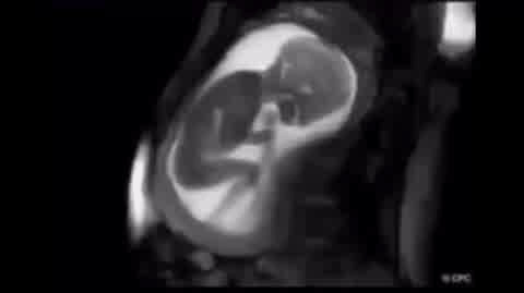 One Of The Clearest Images Of Human Baby Inside Womb Using Mri.. Thankgod We Don't Remember What It Was Like In Womb Cause It Looks Uncomfortable And Claustrophobic