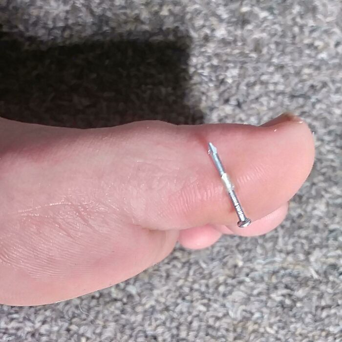 Stepped On A Nail, Barely Escaped Being Impaled