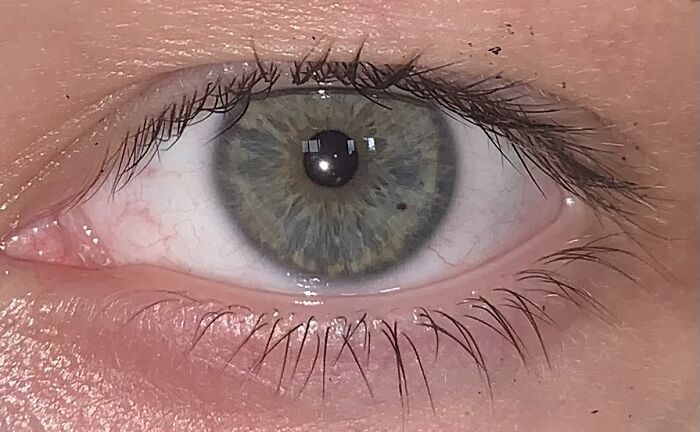 My Friend’s Blue/Gray/Green Eyes
