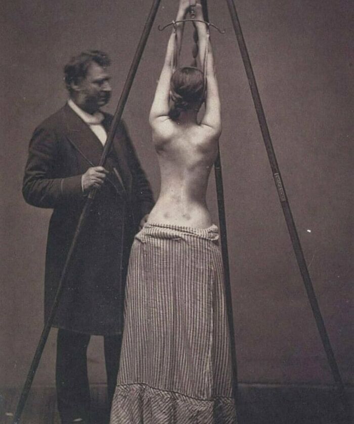 Dr. Lewis Sayre Treating Scoliosis, Checking The Curvature Of The Spine, 1870s
