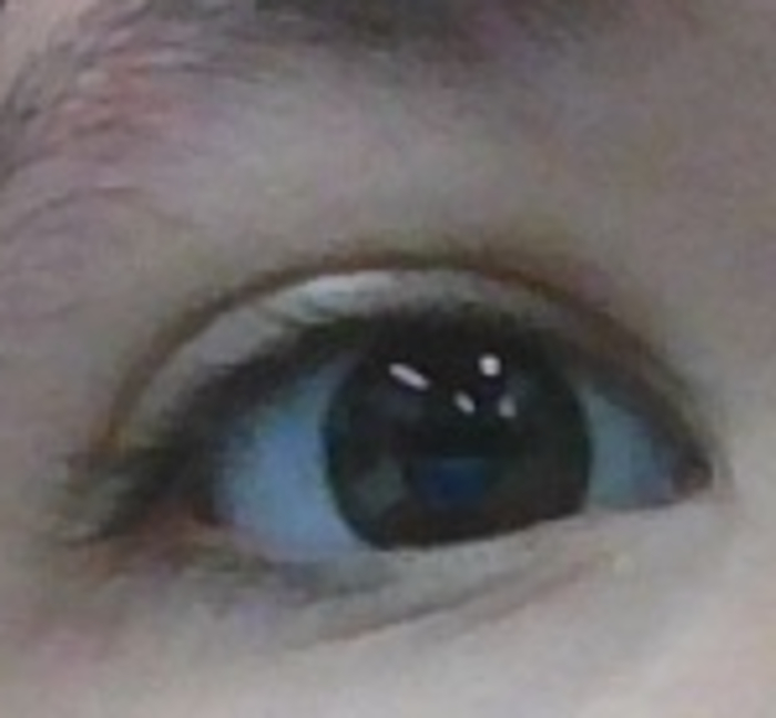 Sorry It's Blurry, But Here's My Eye :3