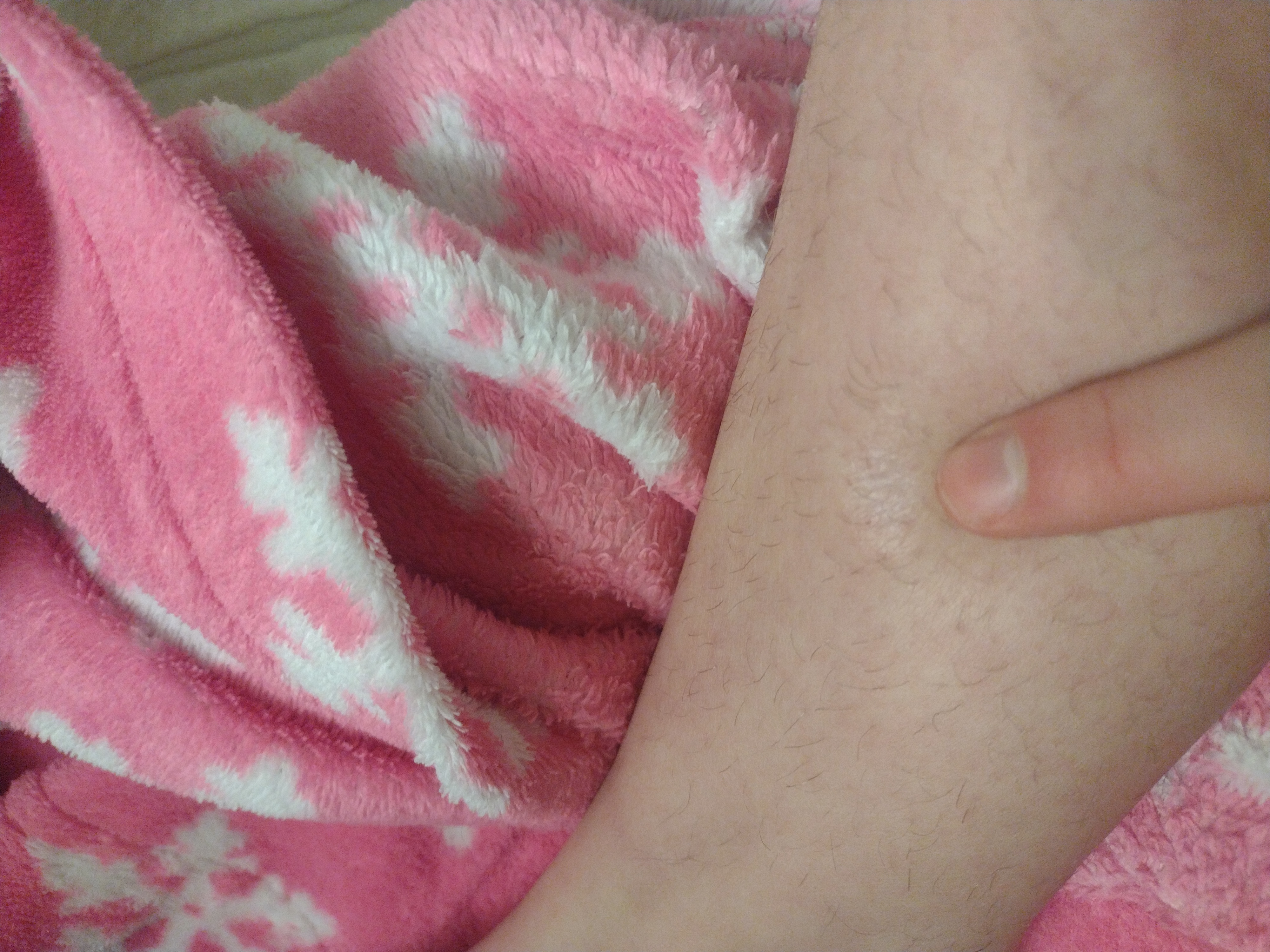 Show Me Your Scars With The Funniest Story’s