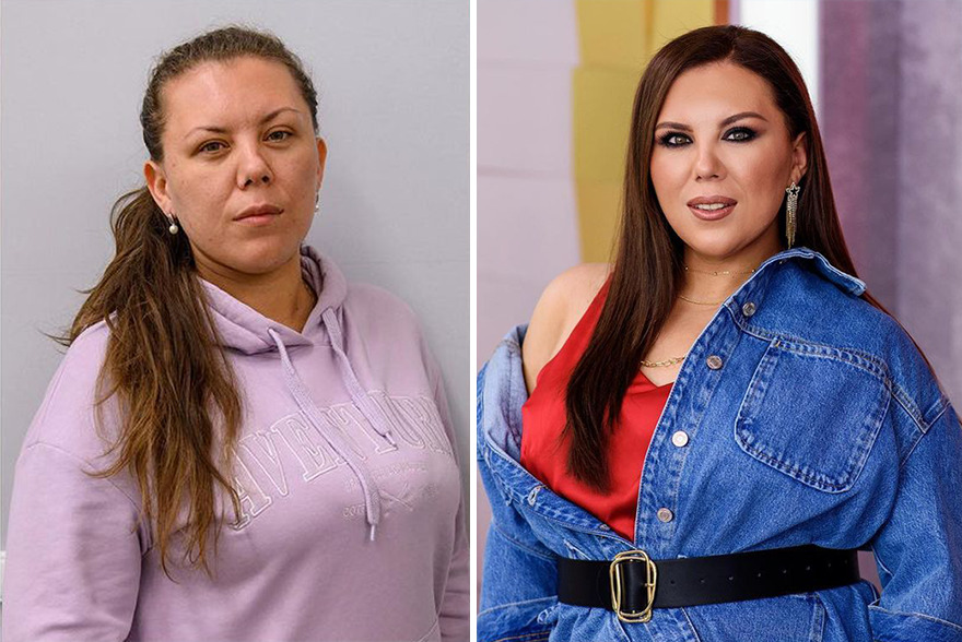 TV Show Gives People An Extreme Makeover, Here Are 52 Of The Best Before-And-After Pics