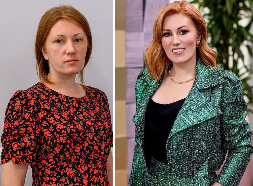 TV Show Gives People An Extreme Makeover, Here Are 52 Of The Best Before-And-After Pics