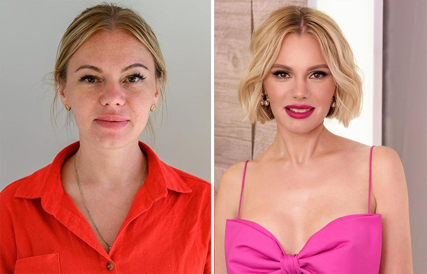 TV Show Gives People An Extreme Makeover, Here Are 52 Of The Best Before-And-After Pics
