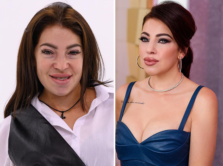 TV Show Gives People An Extreme Makeover, Here Are 52 Of The Best Before-And-After Pics