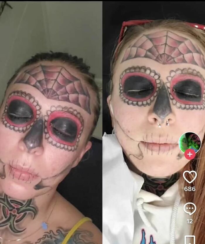 Found On The Tok. She’s Having It Removed.. Wonder Why