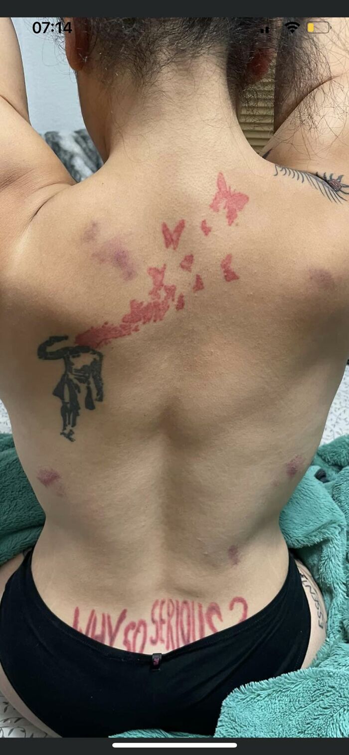 Found In One Of My Other Groups. Her BF Was Taking Pics To Show Off The Hickies He Gave Her. But All I Can See Is The Tattoos