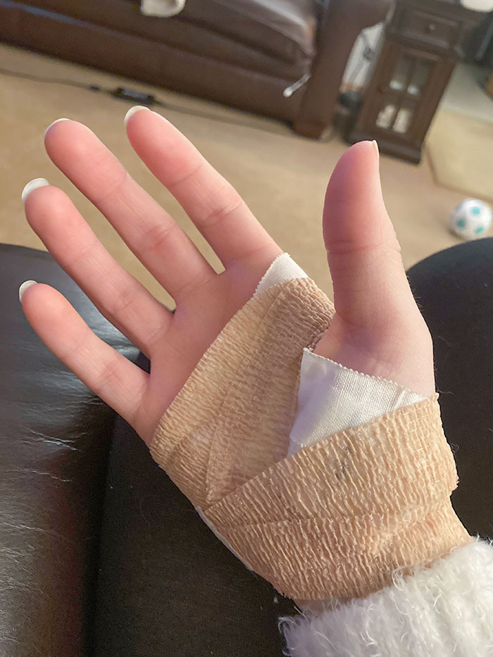 My Husband’s Cat Was Overstimulated And I Didn’t Notice And Went To Give Her A Bow To Play With. She Got Startled And Kicked Me And Sliced My Hand Open With Her Back Claws