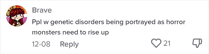 “Are We Really That Scary To Y’all?”: Person With Marfan Syndrome Goes Viral With 1M Views For Calling Out Horror Writers’ Choice In Monster Design “Are We Really That Scary To Y’all?”: Person With Marfan Syndrome Goes Viral With 1M Views For Calling Out Horror Writers’ Choice In Monster Design