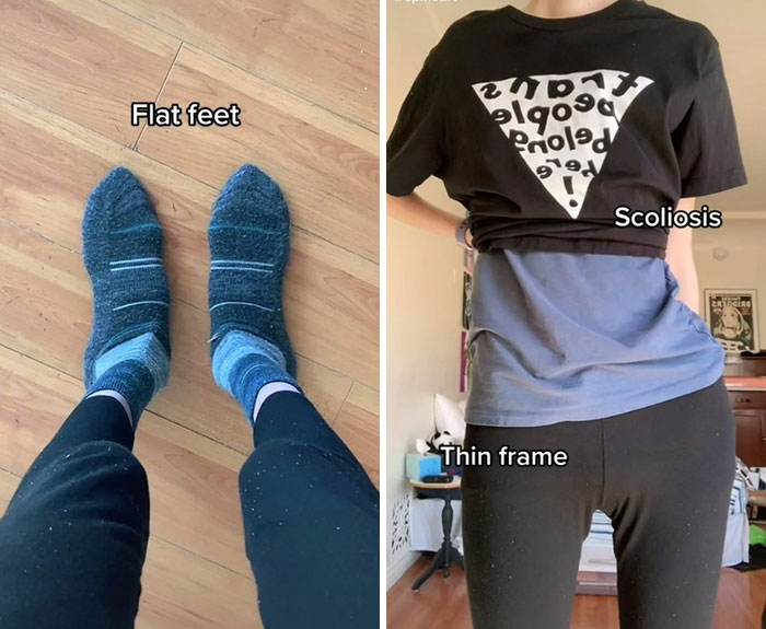 “Are We Really That Scary To Y’all?”: Person With Marfan Syndrome Goes Viral With 1M Views For Calling Out Horror Writers’ Choice In Monster Design “Are We Really That Scary To Y’all?”: Person With Marfan Syndrome Goes Viral With 1M Views For Calling Out Horror Writers’ Choice In Monster Design