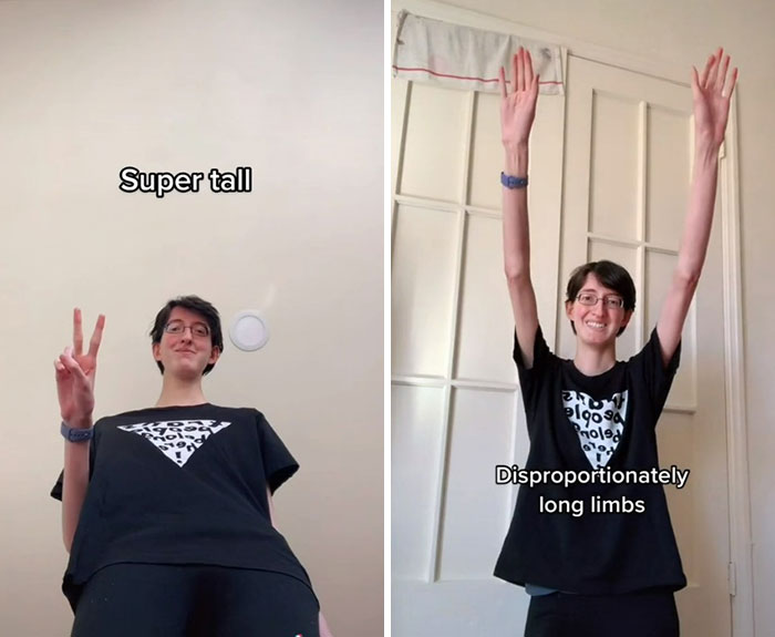 “Are We Really That Scary To Y’all?”: Person With Marfan Syndrome Goes Viral With 1M Views For Calling Out Horror Writers’ Choice In Monster Design “Are We Really That Scary To Y’all?”: Person With Marfan Syndrome Goes Viral With 1M Views For Calling Out Horror Writers’ Choice In Monster Design