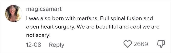 “Are We Really That Scary To Y’all?”: Person With Marfan Syndrome Goes Viral With 1M Views For Calling Out Horror Writers’ Choice In Monster Design “Are We Really That Scary To Y’all?”: Person With Marfan Syndrome Goes Viral With 1M Views For Calling Out Horror Writers’ Choice In Monster Design