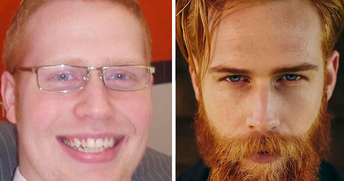 155 Awesome Before And After Photos Of Men Who Underwent Full-On Makeovers