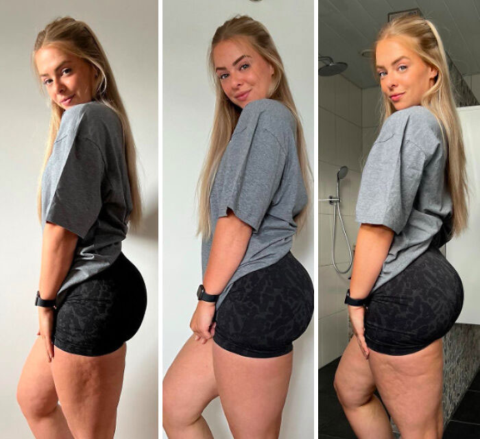 Same Legs Different Lighting For This Fitness Influencer - It's Time To Love Your Lumps And Bumps