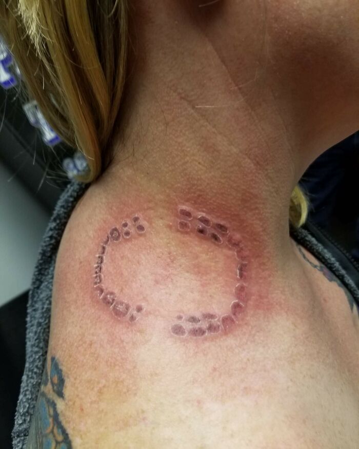 Esta mujer quería tatuarse la mordedura de su marido