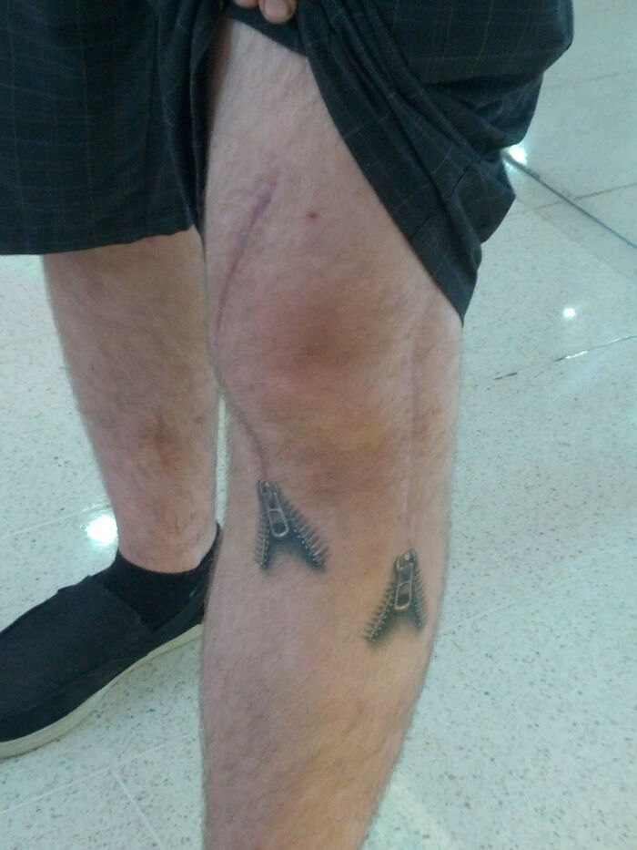 Mate Was In An Accident And Had Two Scars On His Leg. Took The Best Out Of A Bad Situation