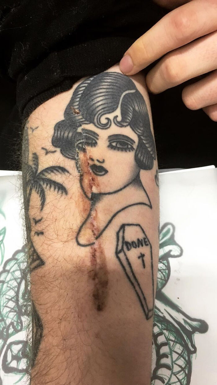 My Friend Broke His Arm And The Surgery Misaligned His Tattoo