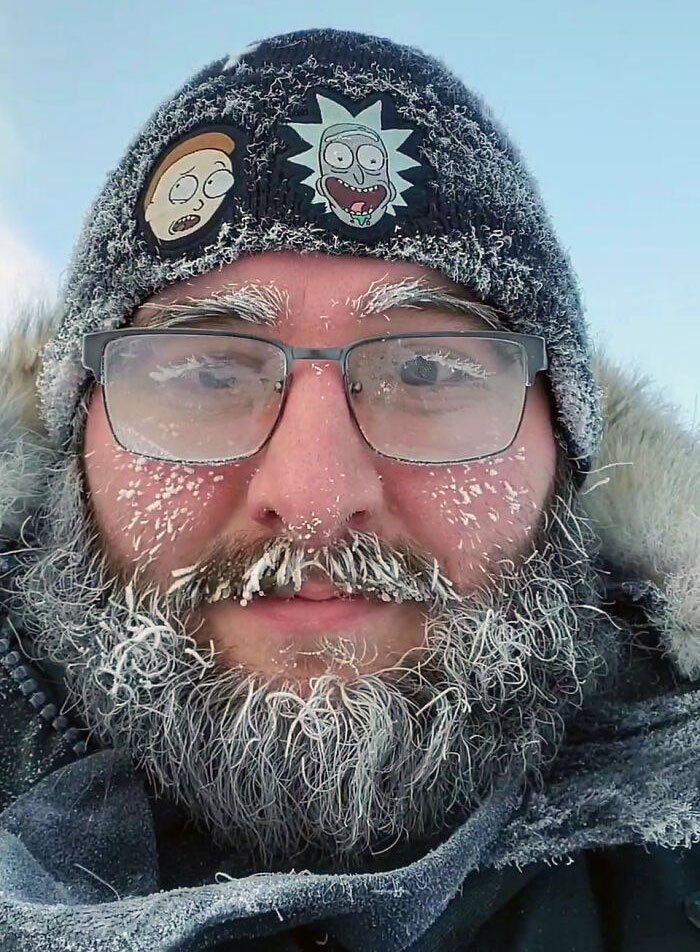 This Is My Face After Just 15 Minutes Of Walking With The Dog Today At -40. Northwest Territories, Canada