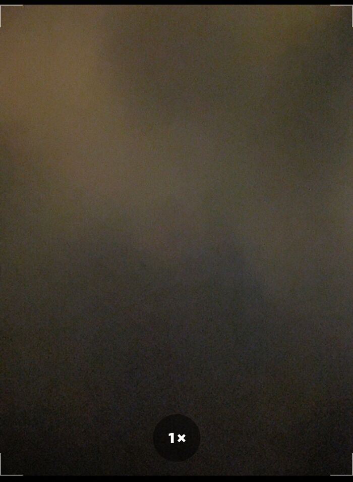 Sorry, I Can’t Show You My Scar That Is On My Back. It Is Fro