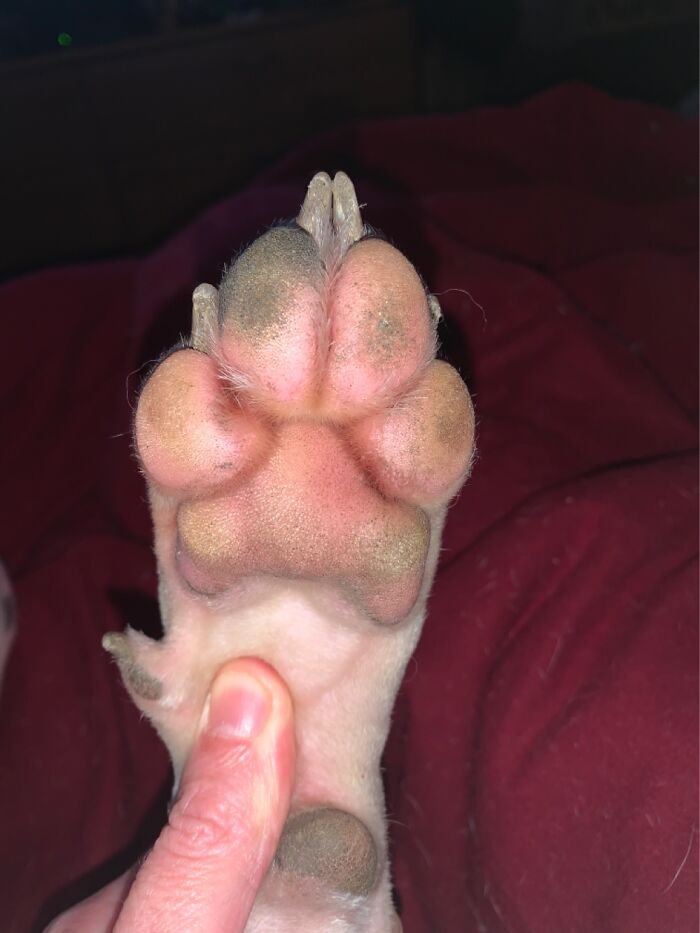 Huge Toe Beans ( My Thumb For Size Comparison )